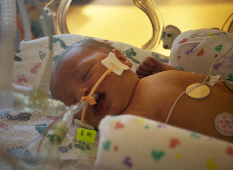 Breathing Support for Infants IDS Medical Systems News