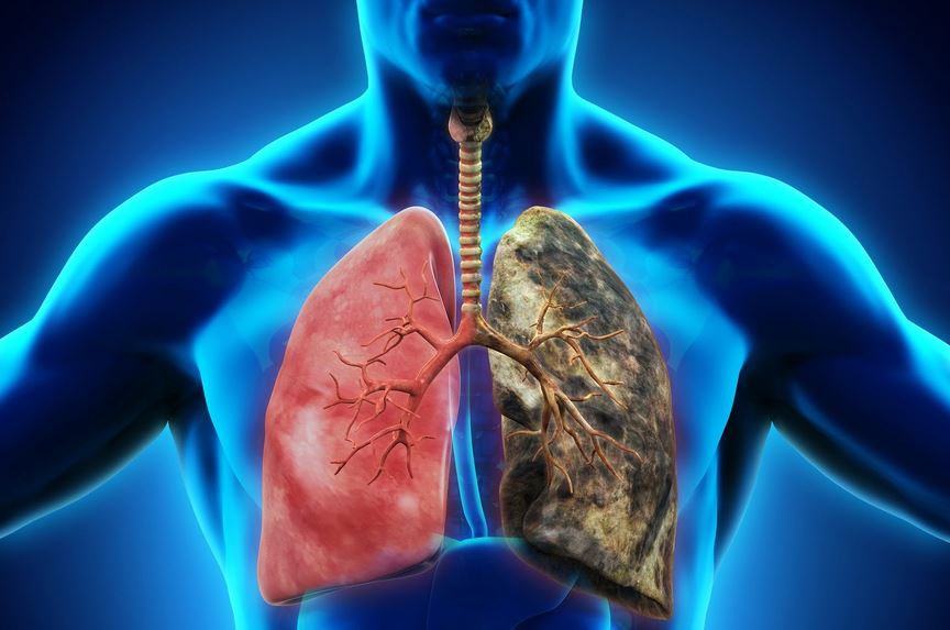 Respiratory Diseases: The Leading Cause of Death That Most P...